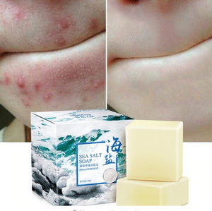 Pimple Pores Acne Treatment